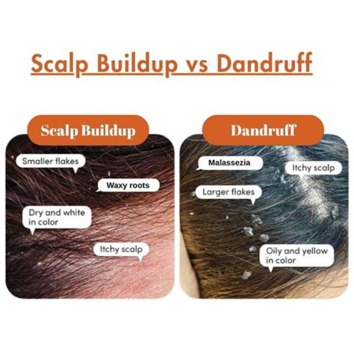 Can sebum cause itchy scalp?