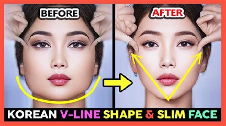 How to get v shaped face?